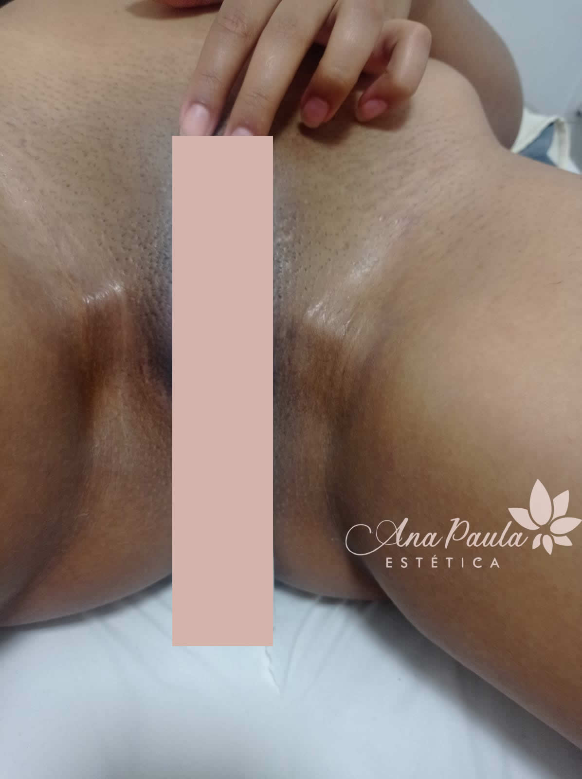 Slider Antes e Depois