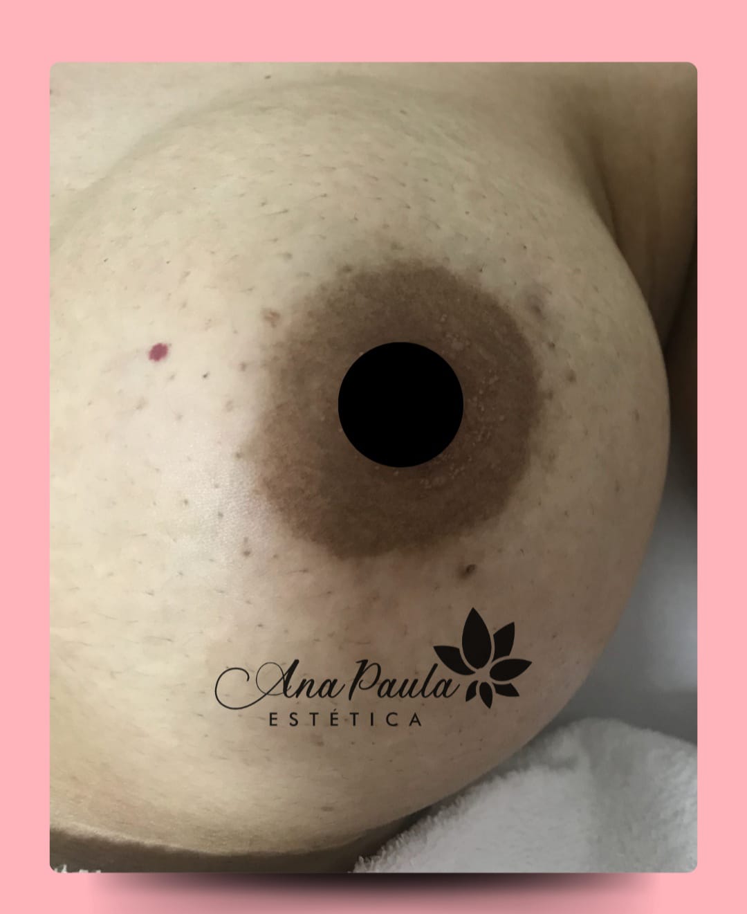 Slider Antes e Depois