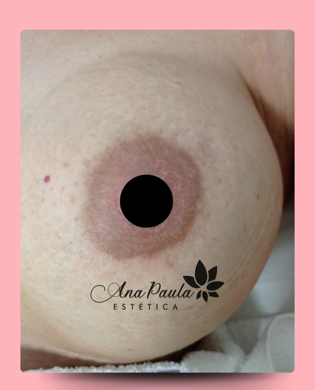 Slider Antes e Depois