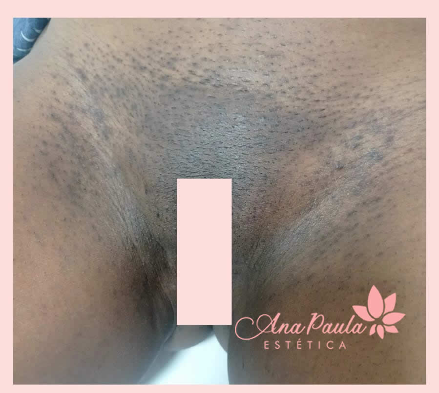 Slider Antes e Depois