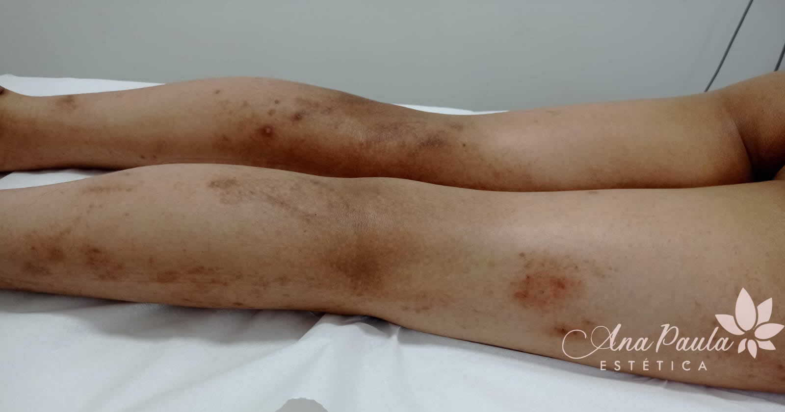 Slider Antes e Depois