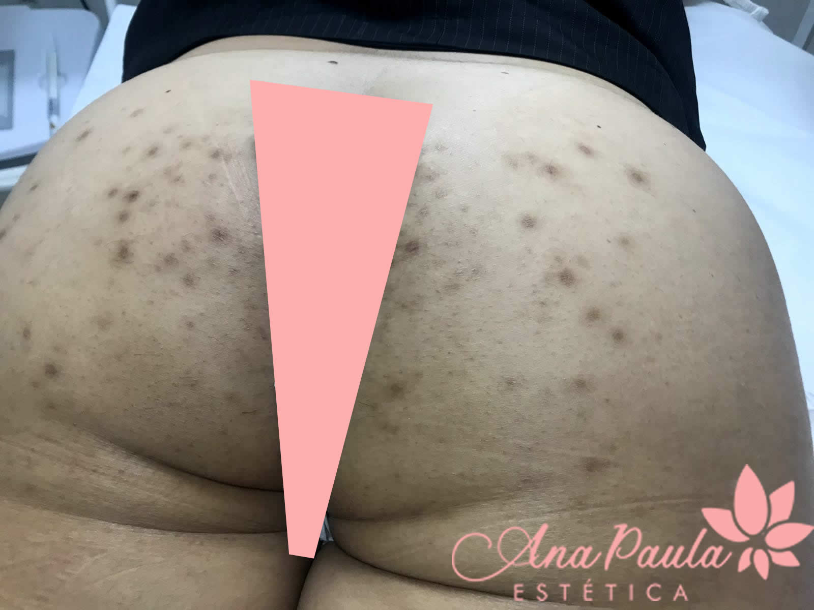 Slider Antes e Depois