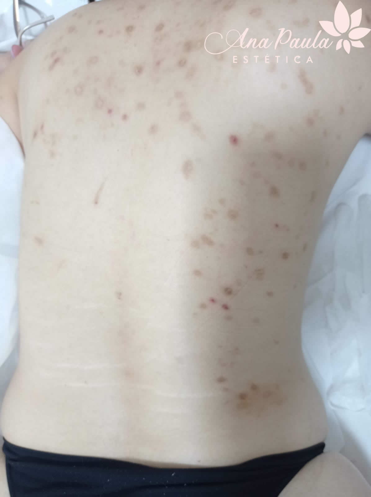 Slider Antes e Depois