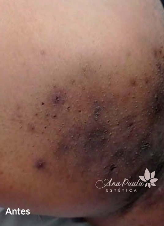 Slider Antes e Depois