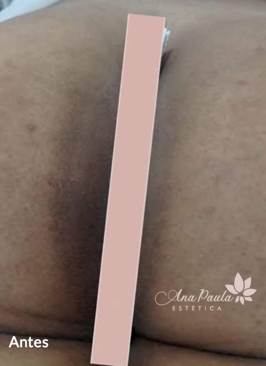 Slider Antes e Depois